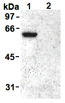 AM26448AF-N - Vimentin