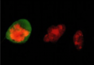 AM26448AF-N - Vimentin