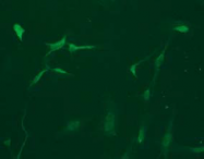 AM26458AF-N - Vimentin