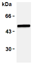 AM26459AF-N - Vimentin