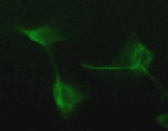 AM26460AF-N - Vimentin