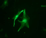 AM26461AF-N - Vimentin