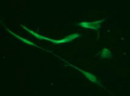 AM26464AF-N - Vimentin