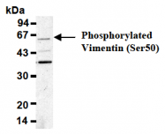 AM26472AF-N - Vimentin
