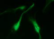 AM26472AF-N - Vimentin