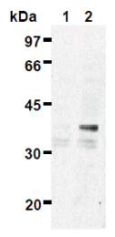 AM26480AF-N - ES1 protein homolog