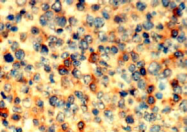 AM26490AF-N - ABI1 / SSH3BP1