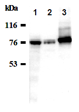 AM26492AF-N - ATP1A1