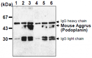 AM26513AF-N - Podoplanin