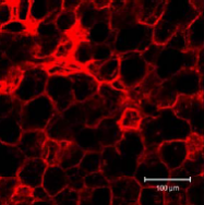 AM26513AF-N - Podoplanin