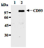 AM26516AF-N - CD93 / C1QR1