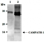 AM26521AF-N - CD52 / CAMPATH-1