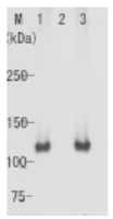 AM26542AF-S - Retinoblastoma-associated protein / RB1