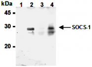 AM26561BT-N - SOCS1