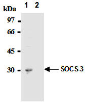 AM26562AF-N - SOCS3 / CIS3