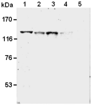 AM26563AF-N - SREBF1 / SREBP1
