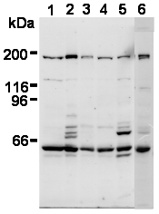 AM26568AF-N - Separin / ESPL1
