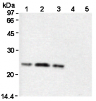 AM26578AF-N - Glutathione peroxidase 1 / GPX1