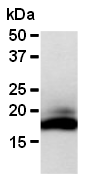 AM26581AF-N - RNASE2