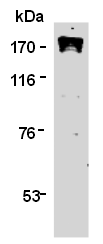 AM26582AF-N - TOP2A
