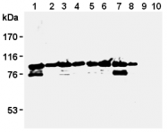 AM26592AF-N - MCM3