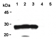 AM26596AF-N - DJ-1 / PARK7