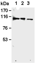 AM26598AF-N - Retinoblastoma-associated protein / RB1
