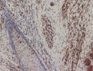 AM26599AF-N - GFP
