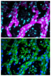AM26599AF-N - GFP