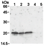 AM26611AF-N - Superoxide Dismutase 1 / SOD1