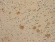 AM26615AF-N - Apolipoprotein E / Apo E