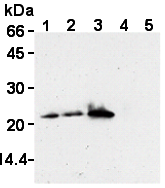 AM26619AF-N - BID