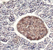 AM26629AF-N - Insulin