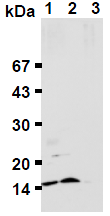 AM26659AF-N - Ubiquitin