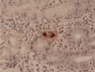 AM26669SU-N - Gastrin