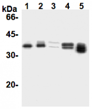 AM26674AF-N - Cyclin D1