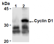 AM26674AF-N - Cyclin D1