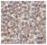 AM26674AF-N - Cyclin D1
