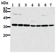 AM26676PU-N - CDK2