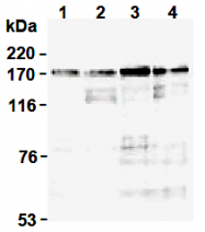 AM26690AF-N - TOP2A / TOP2B