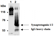 AM26691AF-N - Synaptotagmin 1 + 2