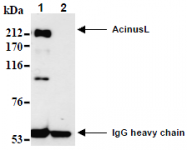 AM26695AF-N - Acinus / ACIN1