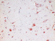 AM26742PU-N - Huntingtin
