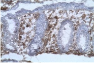 AM31223AF-N - CD40
