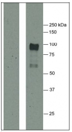 AM31995PU-N - Fibrinogen