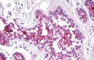 AM32170PU-N - CD227 / Mucin-1 / MUC1