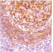 AM32444PU-N - CD23