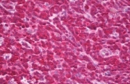 AM32454PU-N - PTPN7 / HEPTP