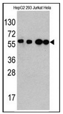 AM32462SU-N - Beclin-1