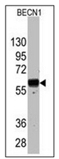 AM32462SU-N - Beclin-1